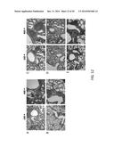 COMBINED ANTIGEN AND DNA VACCINE FOR PREVENTING AND TREATING RSV INFECTION diagram and image