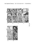 COMBINED ANTIGEN AND DNA VACCINE FOR PREVENTING AND TREATING RSV INFECTION diagram and image