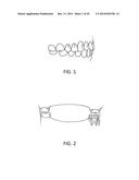 Orthodontic Appliance diagram and image