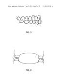 Orthodontic Appliance diagram and image