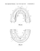 Orthodontic Appliance diagram and image