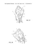 Orthodontic Appliance diagram and image