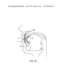 Orthodontic Appliance diagram and image