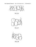 Orthodontic Appliance diagram and image