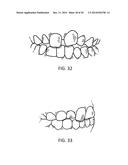 Orthodontic Appliance diagram and image