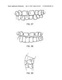 Orthodontic Appliance diagram and image