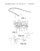 CUSTOMIZED ORTHODONTIC BRACKET SYSTEM diagram and image