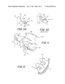 CUSTOMIZED ORTHODONTIC BRACKET SYSTEM diagram and image