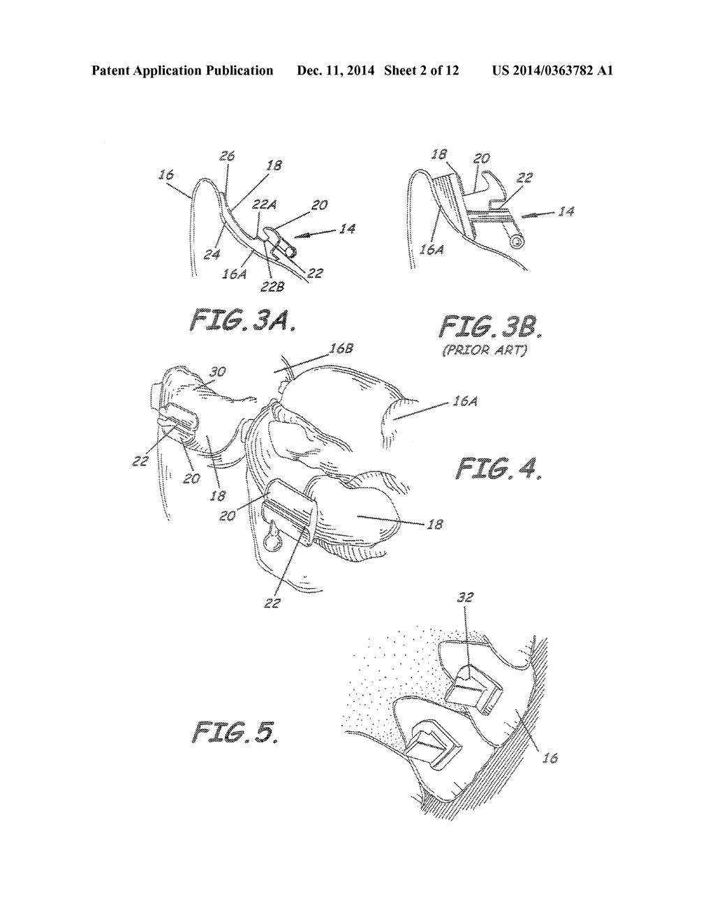 CUSTOMIZED ORTHODONTIC BRACKET SYSTEM - diagram, schematic, and image 03