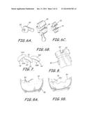 CUSTOMIZED ORTHODONTIC BRACKET SYSTEM diagram and image