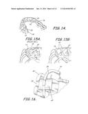 CUSTOMIZED ORTHODONTIC BRACKET SYSTEM diagram and image