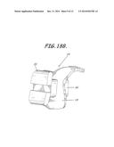 CUSTOMIZED ORTHODONTIC BRACKET SYSTEM diagram and image