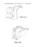 CUSTOMIZED ORTHODONTIC BRACKET SYSTEM diagram and image