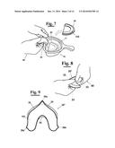 METHOD FOR MAKING AN IMPRESSION TRAY FOR DENTAL USE diagram and image