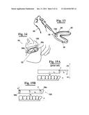 METHOD FOR MAKING AN IMPRESSION TRAY FOR DENTAL USE diagram and image