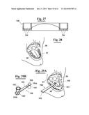 METHOD FOR MAKING AN IMPRESSION TRAY FOR DENTAL USE diagram and image