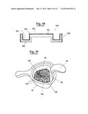 METHOD FOR MAKING AN IMPRESSION TRAY FOR DENTAL USE diagram and image