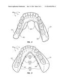 STABILIZER FOR LOWER DENTAL APPLIANCES diagram and image