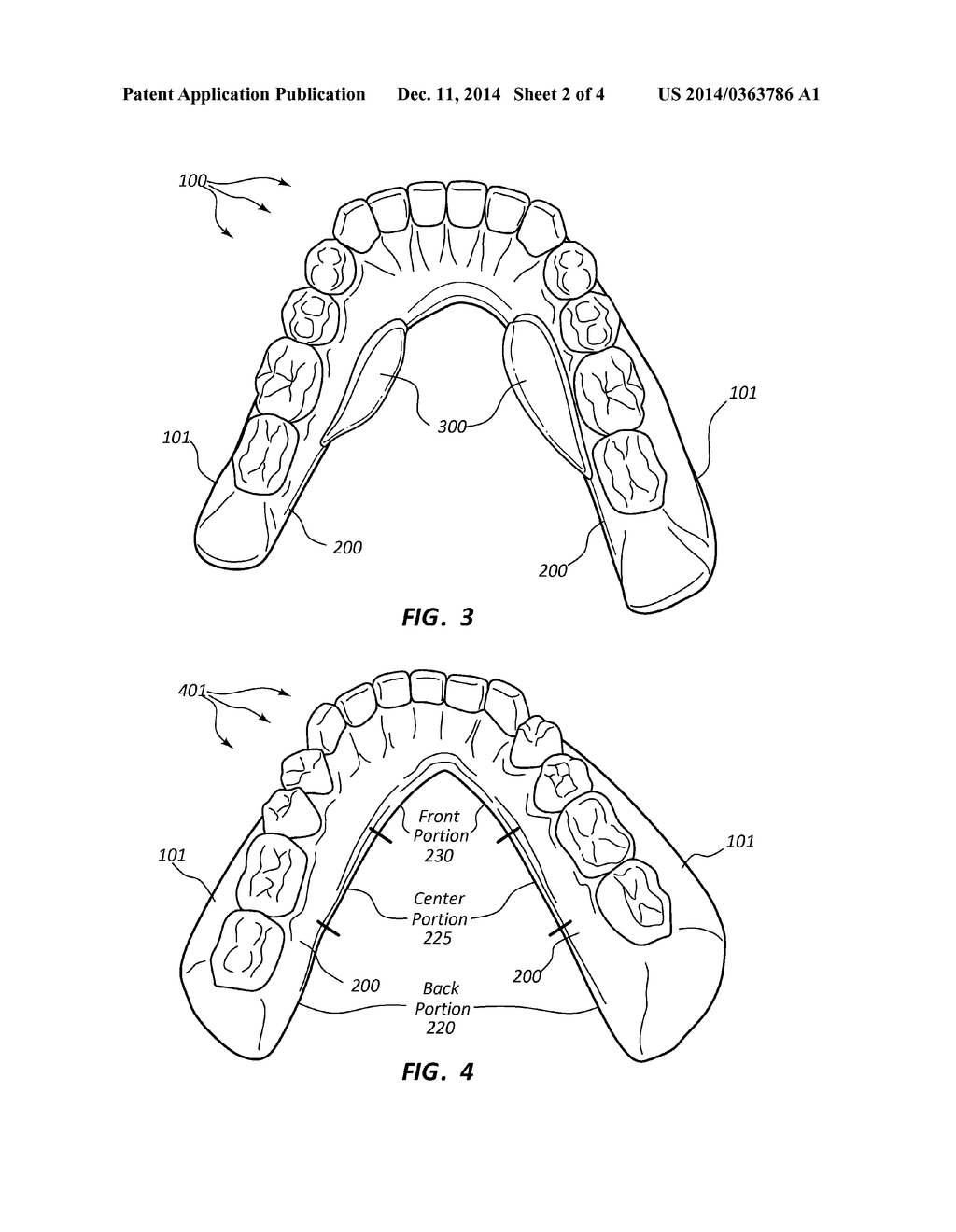 STABILIZER FOR LOWER DENTAL APPLIANCES - diagram, schematic, and image 03