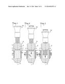 Expandable dental implant and method of use diagram and image