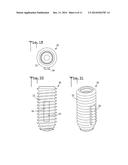 Expandable dental implant and method of use diagram and image