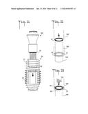 Expandable dental implant and method of use diagram and image