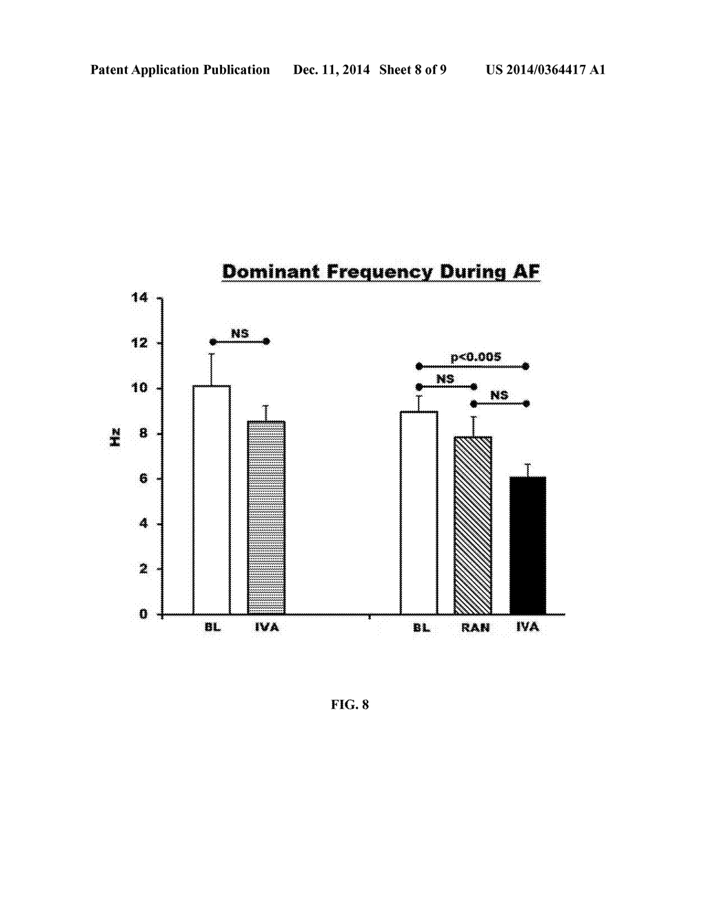 METHOD OF TREATING ATRIAL FIBRILLATION - diagram, schematic, and image 09