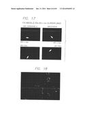 PSCA: PROSTATE STEM CELL ANTIGEN AND USES THEREOF diagram and image