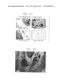 PSCA: PROSTATE STEM CELL ANTIGEN AND USES THEREOF diagram and image