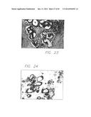 PSCA: PROSTATE STEM CELL ANTIGEN AND USES THEREOF diagram and image