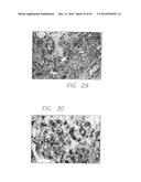 PSCA: PROSTATE STEM CELL ANTIGEN AND USES THEREOF diagram and image