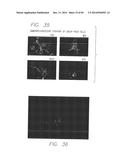 PSCA: PROSTATE STEM CELL ANTIGEN AND USES THEREOF diagram and image