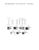 PSCA: PROSTATE STEM CELL ANTIGEN AND USES THEREOF diagram and image