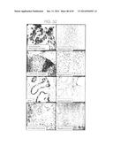 PSCA: PROSTATE STEM CELL ANTIGEN AND USES THEREOF diagram and image