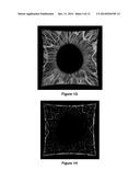 Non-Invasive Ocular Analyte Sensing System diagram and image