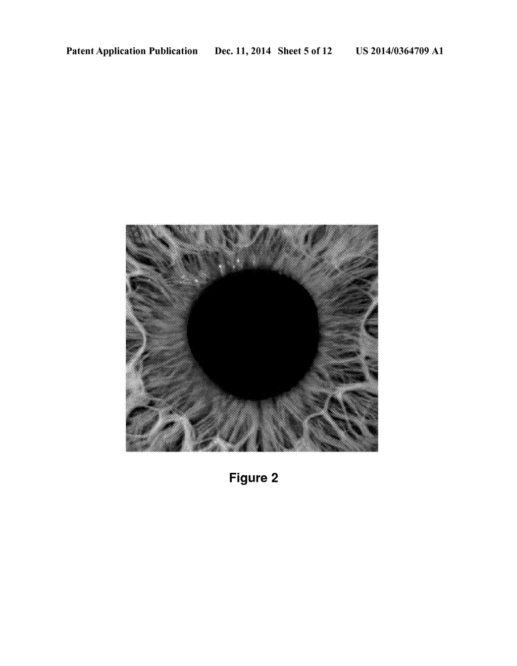 Non-Invasive Ocular Analyte Sensing System - diagram, schematic, and image 06