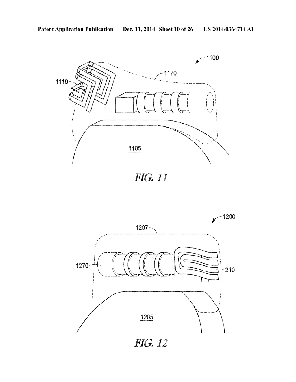 ANTENNAS FOR IMPLANTABLE MEDICAL DEVICES - diagram, schematic, and image 11