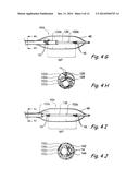 SYSTEMS AND METHODS FOR PERFORMING IMAGE GUIDED PROCEDURES WITHIN THE EAR,     NOSE, THROAT AND PARANASAL SINUSES diagram and image