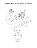 SYSTEMS AND METHODS FOR PERFORMING IMAGE GUIDED PROCEDURES WITHIN THE EAR,     NOSE, THROAT AND PARANASAL SINUSES diagram and image