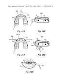 SYSTEMS AND METHODS FOR PERFORMING IMAGE GUIDED PROCEDURES WITHIN THE EAR,     NOSE, THROAT AND PARANASAL SINUSES diagram and image