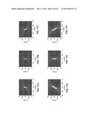 TIME REVERSAL AND PHASE COHERENT MUSIC TECHNIQUES FOR SUPER-RESOLUTION     ULTRASOUND IMAGING diagram and image