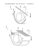 SYSTEMS AND METHODS FOR SYNTHETIC APERTURE ULTRASOUND TOMOGRAPHY diagram and image