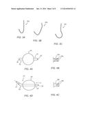 SYSTEMS AND METHODS FOR PERFORMING MEDICAL PROCEDURES INVOLVING ACCESSING     THE LYMPHATIC SYSTEM diagram and image