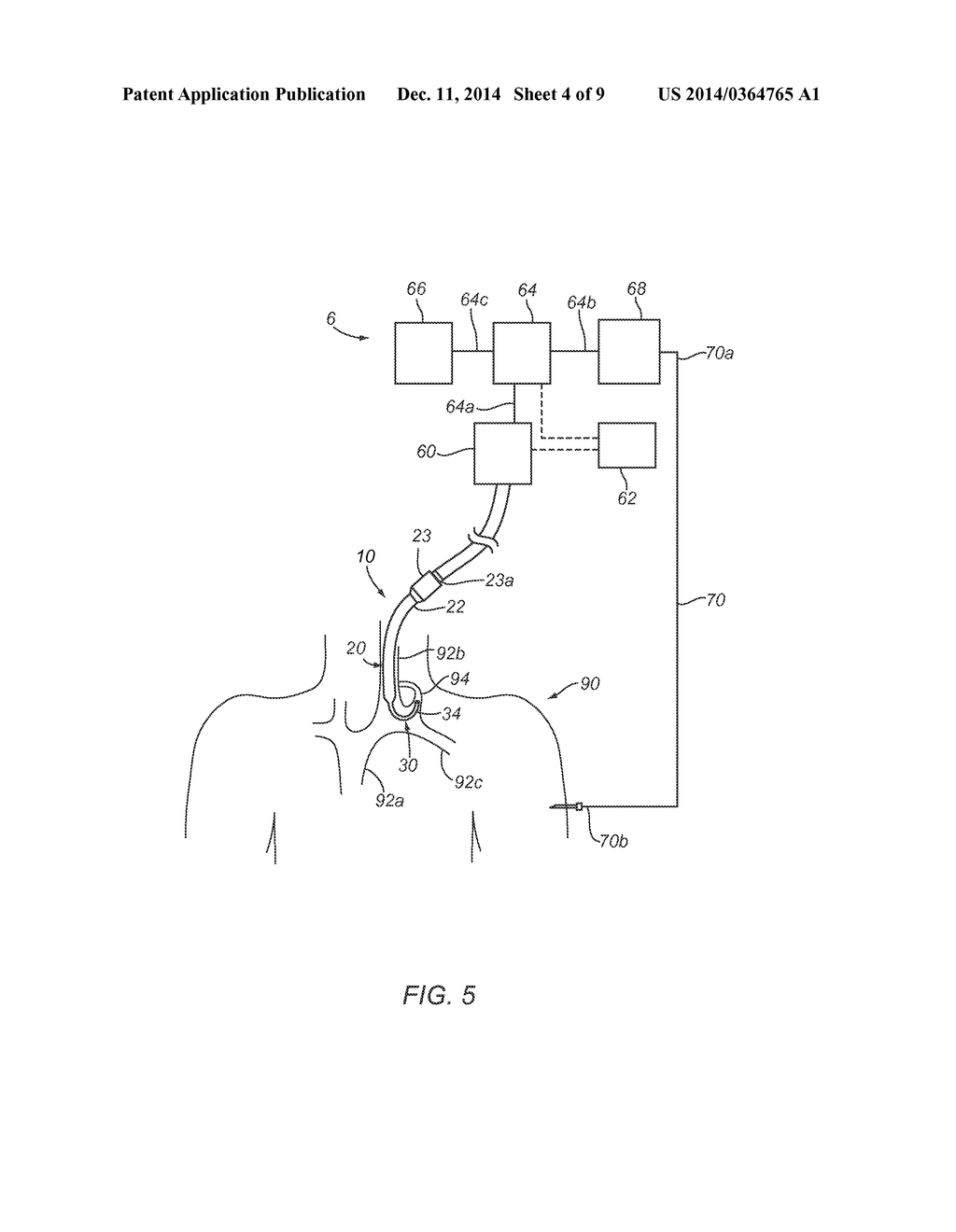 SYSTEMS AND METHODS FOR PERFORMING MEDICAL PROCEDURES INVOLVING ACCESSING     THE LYMPHATIC SYSTEM - diagram, schematic, and image 05