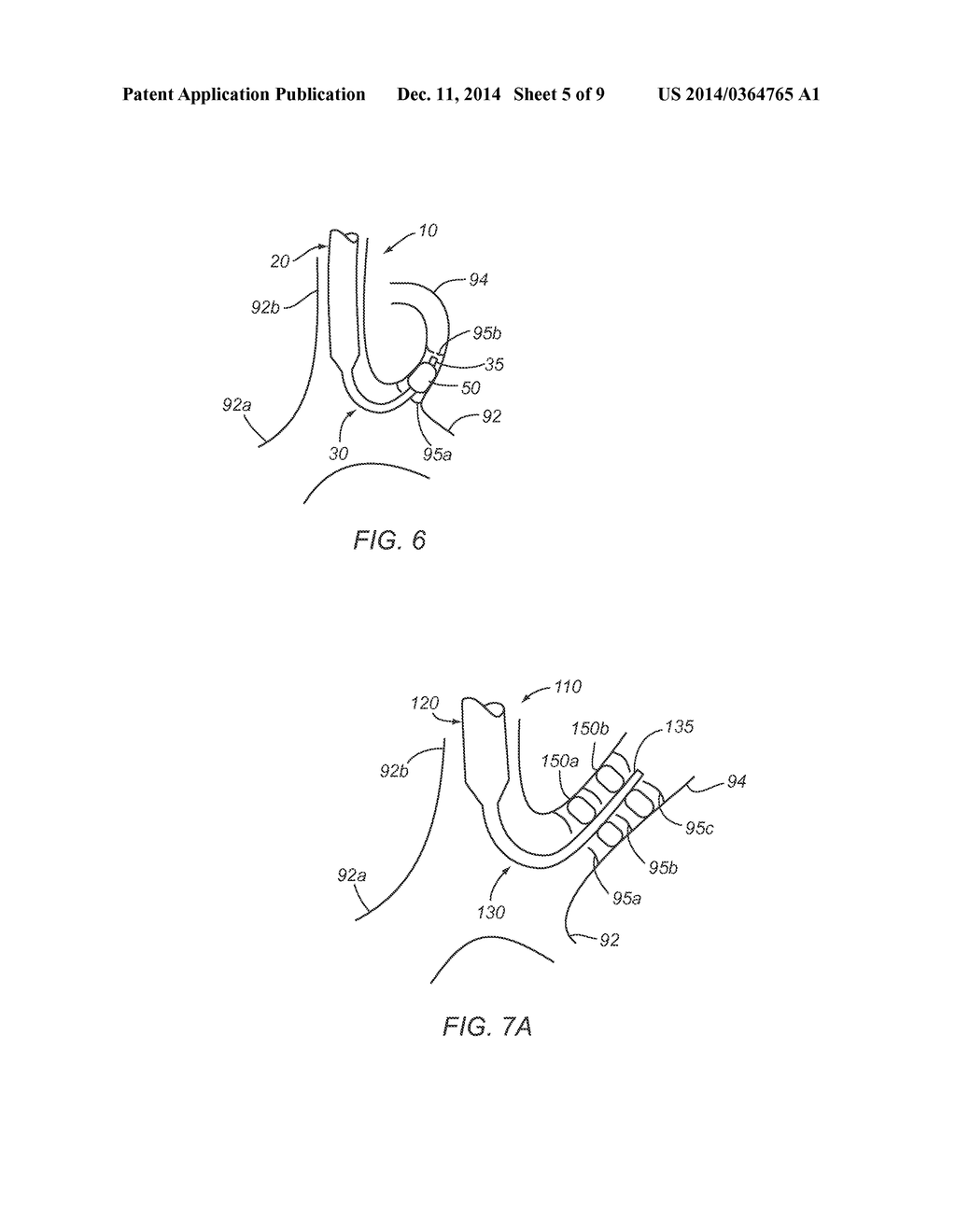 SYSTEMS AND METHODS FOR PERFORMING MEDICAL PROCEDURES INVOLVING ACCESSING     THE LYMPHATIC SYSTEM - diagram, schematic, and image 06