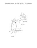 SYSTEMS AND METHODS FOR PERFORMING MEDICAL PROCEDURES INVOLVING ACCESSING     THE LYMPHATIC SYSTEM diagram and image