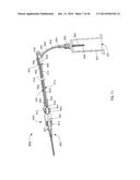 SYSTEMS AND METHODS FOR PHLEBOTOMY THROUGH A PERIPHERAL IV CATHETER diagram and image