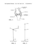 DYNAMIC LOAD BEARING SHOCK ABSORBING EXOSKELETAL KNEE BRACE diagram and image