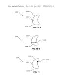 SYSTEMS, DEVICES, AND METHODS FOR TRANSDERMAL DELIVERY diagram and image