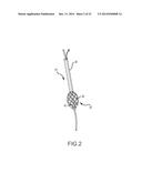 SYSTEM FOR OPTIMIZED COUPLING OF ABLATION CATHETERS TO BODY TISSUES AND     EVAULATION OF LESIONS FORMED BY THE CATHETERS diagram and image